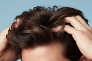 Greffe et soins capillaires